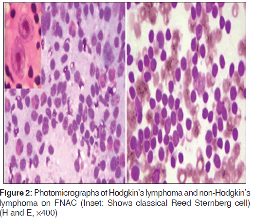 annals-medical-health-sciences-Photomicrographs