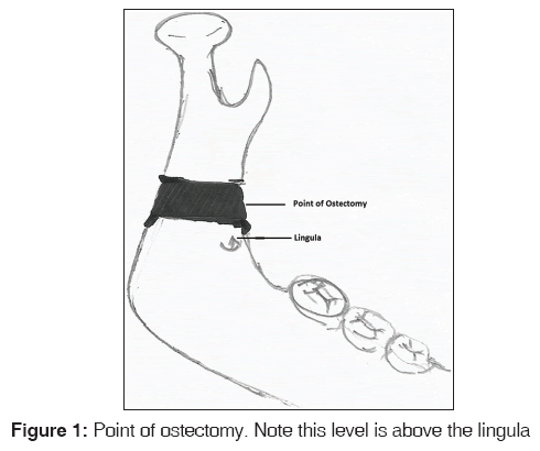 annals-medical-health-sciences-Point-ostectomy