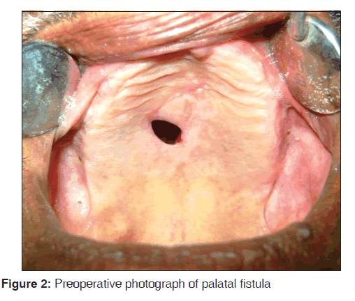 annals-medical-health-sciences-Preoperative