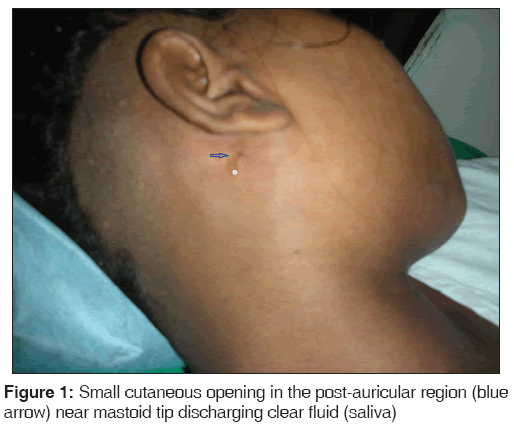 annals-medical-health-sciences-Small-cutaneous