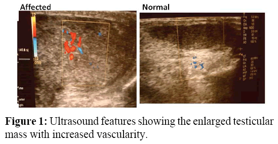 annals-medical-health-sciences-Ultrasound-features