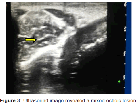 annals-medical-health-sciences-Ultrasound-image