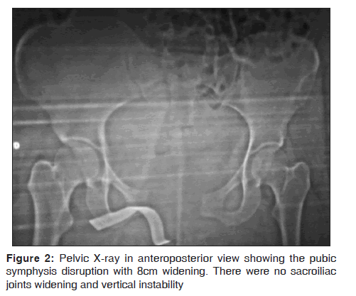 annals-medical-health-sciences-anteroposterior