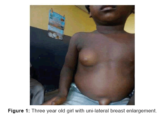 annals-medical-health-sciences-breast-enlargement