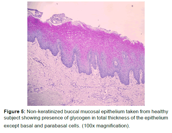 annals-medical-health-sciences-buccal-mucosal