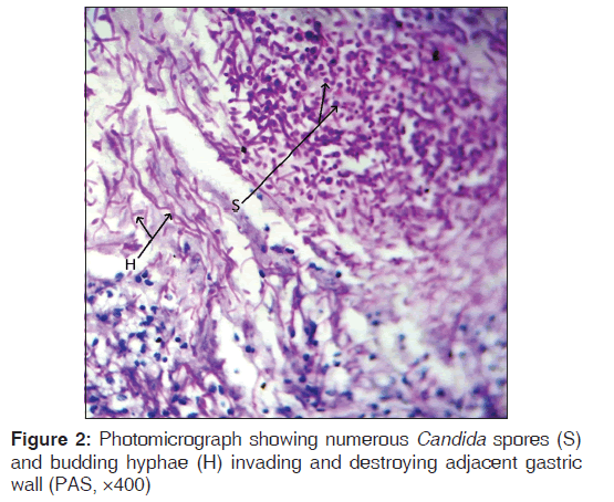 annals-medical-health-sciences-budding-hyphae