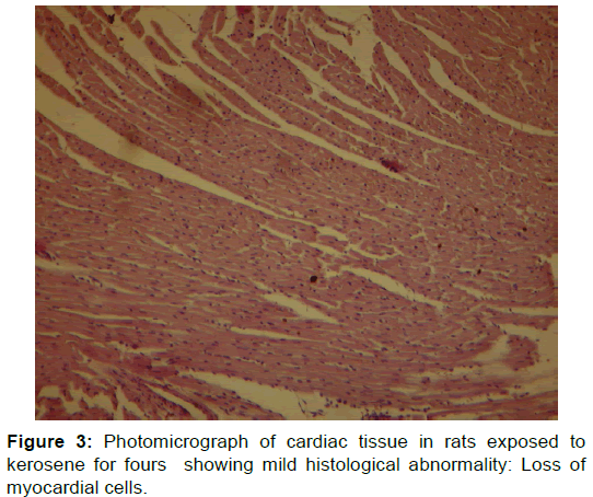 annals-medical-health-sciences-cardiac-tissue