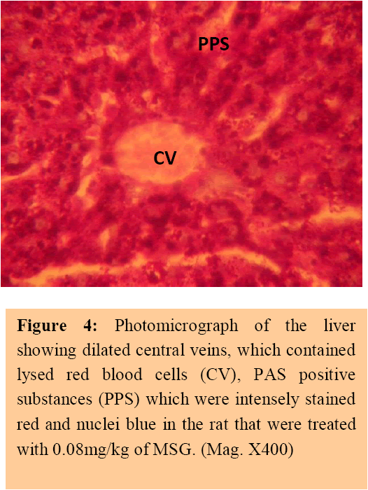 annals-medical-health-sciences-central-veins