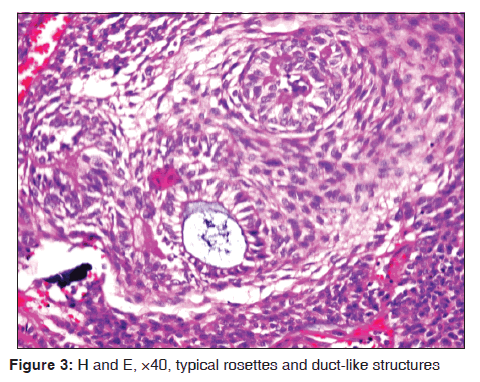 annals-medical-health-sciences-duct-like