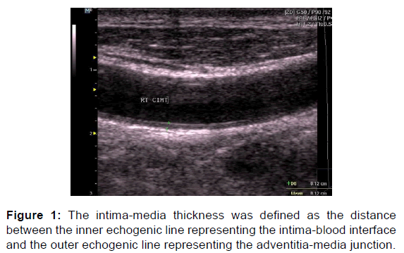 annals-medical-health-sciences-echogenic