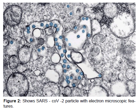 annals-medical-health-sciences-electron-microscopic