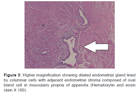 annals-medical-health-sciences-endometrial-