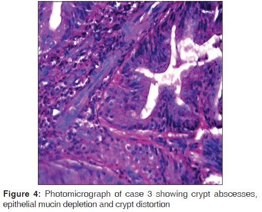 annals-medical-health-sciences-epithelial-mucin