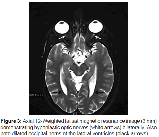 annals-medical-health-sciences-fat-sat-magnetic