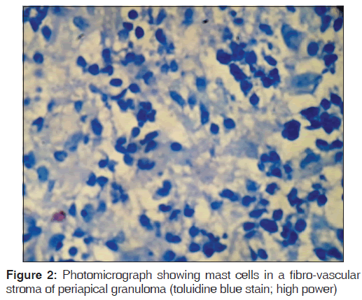 annals-medical-health-sciences-fibro-vascular-stroma