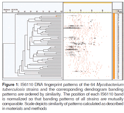 annals-medical-health-sciences-fingerprint-patterns