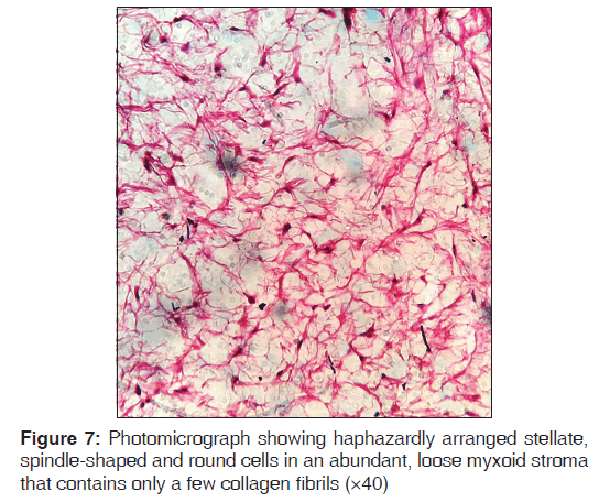 annals-medical-health-sciences-haphazardly-arranged-stellate