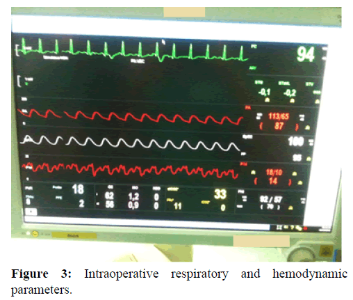 annals-medical-health-sciences-hemodynamic