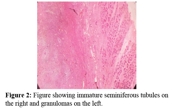 annals-medical-health-sciences-immature-seminiferous