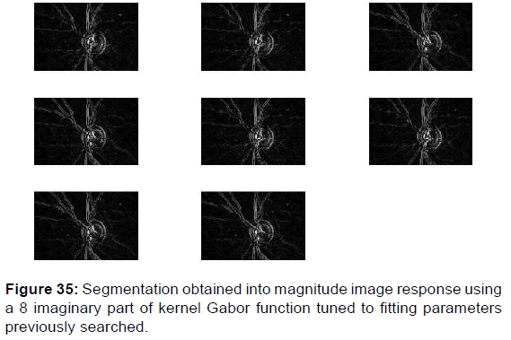 annals-medical-health-sciences-kernel-Gabor