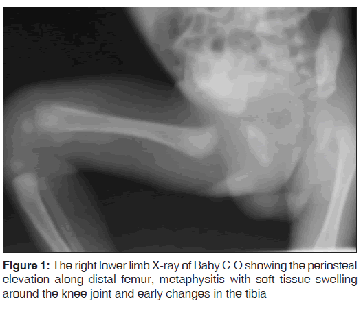 annals-medical-health-sciences-limb-x-ray