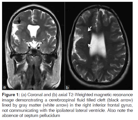 annals-medical-health-sciences-magnetic-resonance