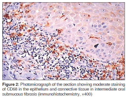 annals-medical-health-sciences-moderate-staining