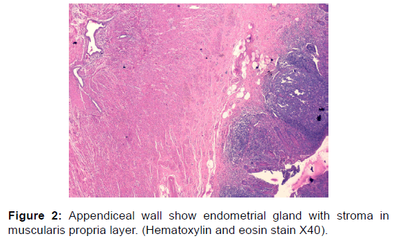 annals-medical-health-sciences-muscularis