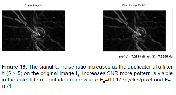 annals-medical-health-sciences-noise-ratio