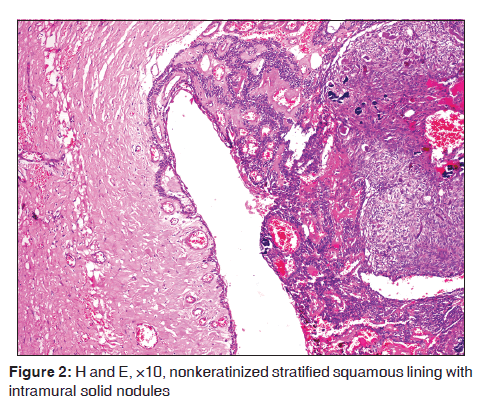 annals-medical-health-sciences-nonkeratinized-stratified