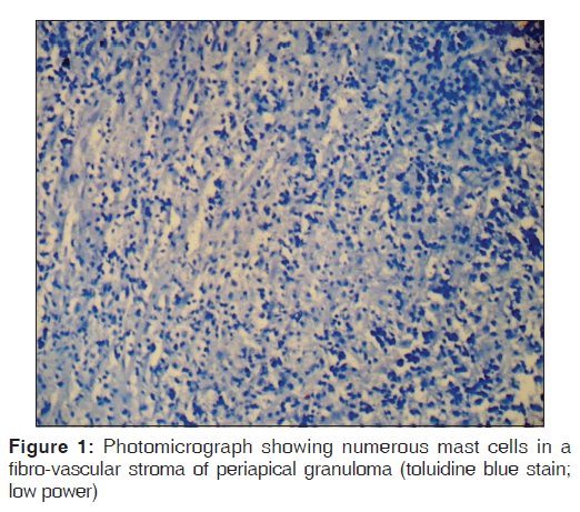 annals-medical-health-sciences-numerous-mast-cells