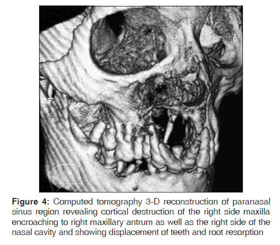 annals-medical-health-sciences-paranasal-sinus-region-revealing-cortical