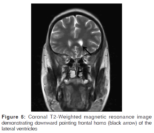 annals-medical-health-sciences-pointing-frontal