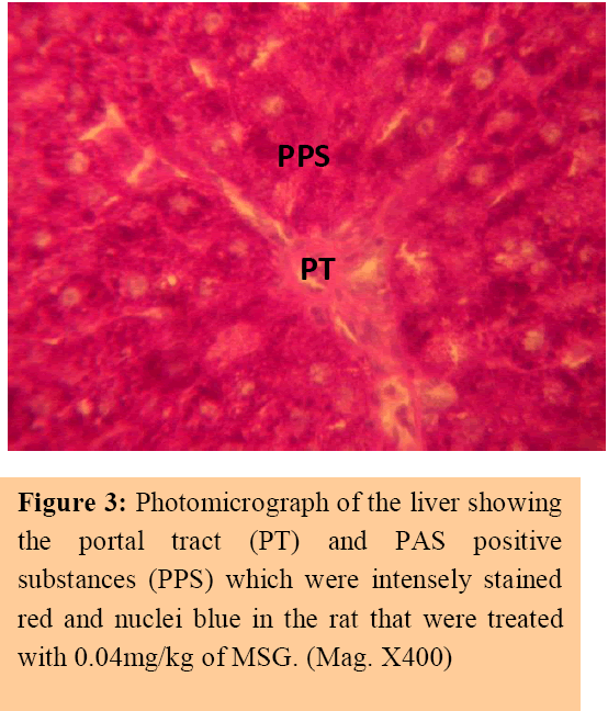 annals-medical-health-sciences-portal-tract