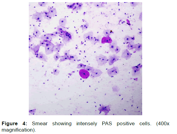 annals-medical-health-sciences-positive-cells