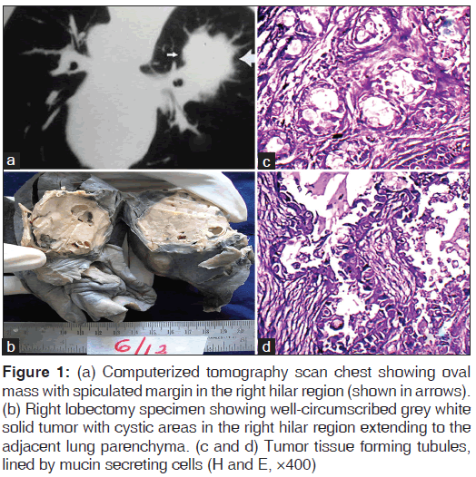 annals-medical-health-sciences-scan-chest