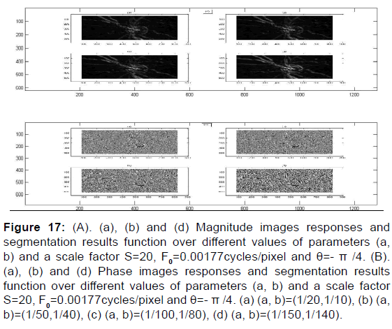 annals-medical-health-sciences-segmentation-results