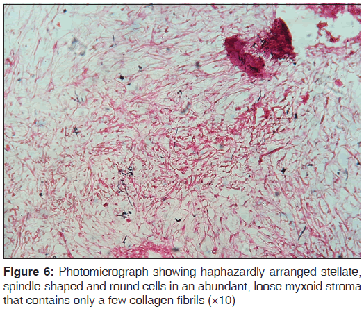 annals-medical-health-sciences-spindle-shaped-round-cells