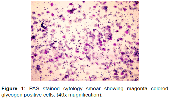 annals-medical-health-sciences-stained-cytology