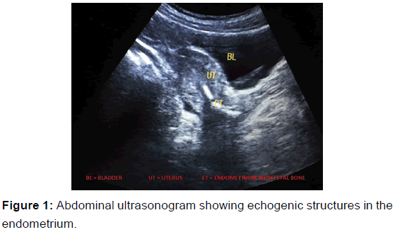 annals-medical-health-sciences-ultrasonogram