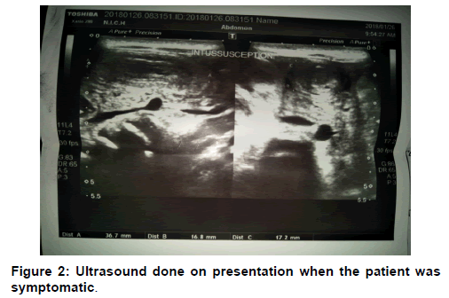 annals-medical-health-sciences-ultrasound