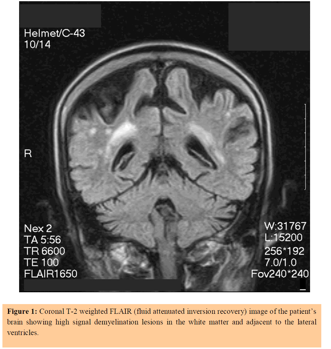 annals-medical-health-sciences-weighted-FLAIR