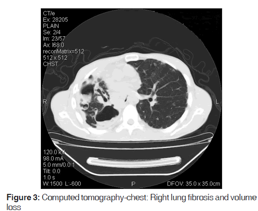 annals-medical-health-tomography-chest