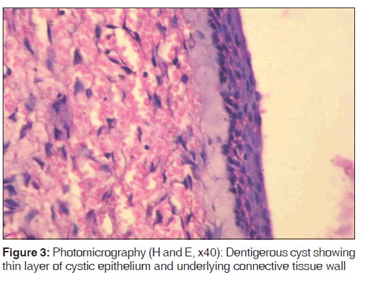 annals-medical-health-underlying-connective