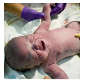 Spouses Perspective of their Participation and Role in Childbirth Pain Relief